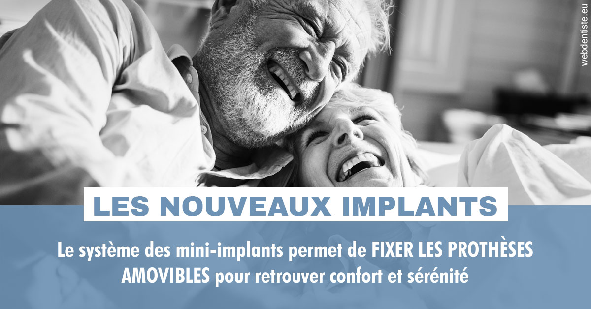 https://dr-nathalie-lambert.chirurgiens-dentistes.fr/Les nouveaux implants 2