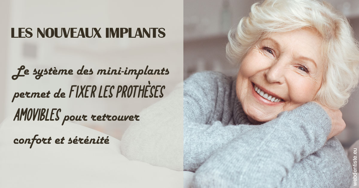 https://dr-nathalie-lambert.chirurgiens-dentistes.fr/Les nouveaux implants 1