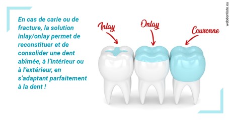 https://dr-nathalie-lambert.chirurgiens-dentistes.fr/L'INLAY ou l'ONLAY