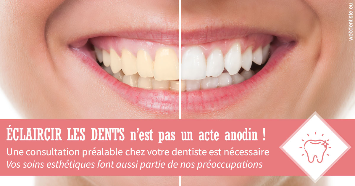 https://dr-nathalie-lambert.chirurgiens-dentistes.fr/Eclaircir les dents 1