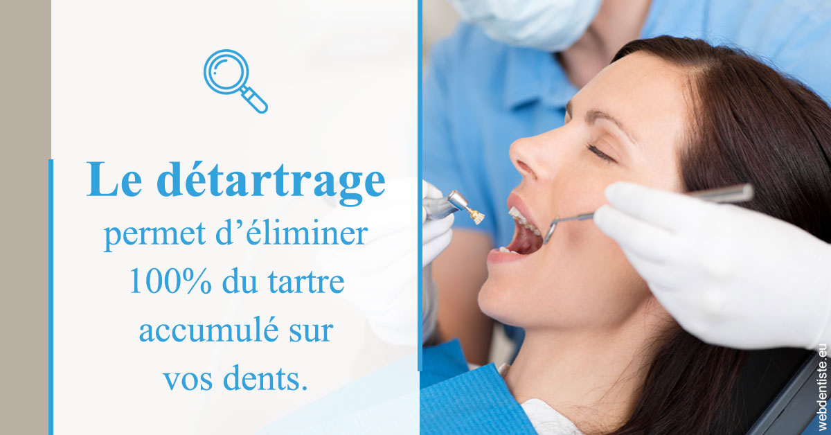 https://dr-nathalie-lambert.chirurgiens-dentistes.fr/En quoi consiste le détartrage