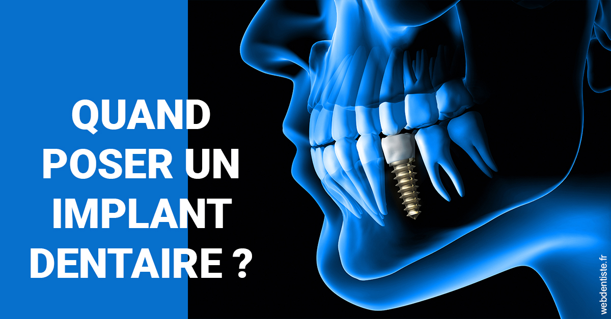 https://dr-nathalie-lambert.chirurgiens-dentistes.fr/Les implants 1