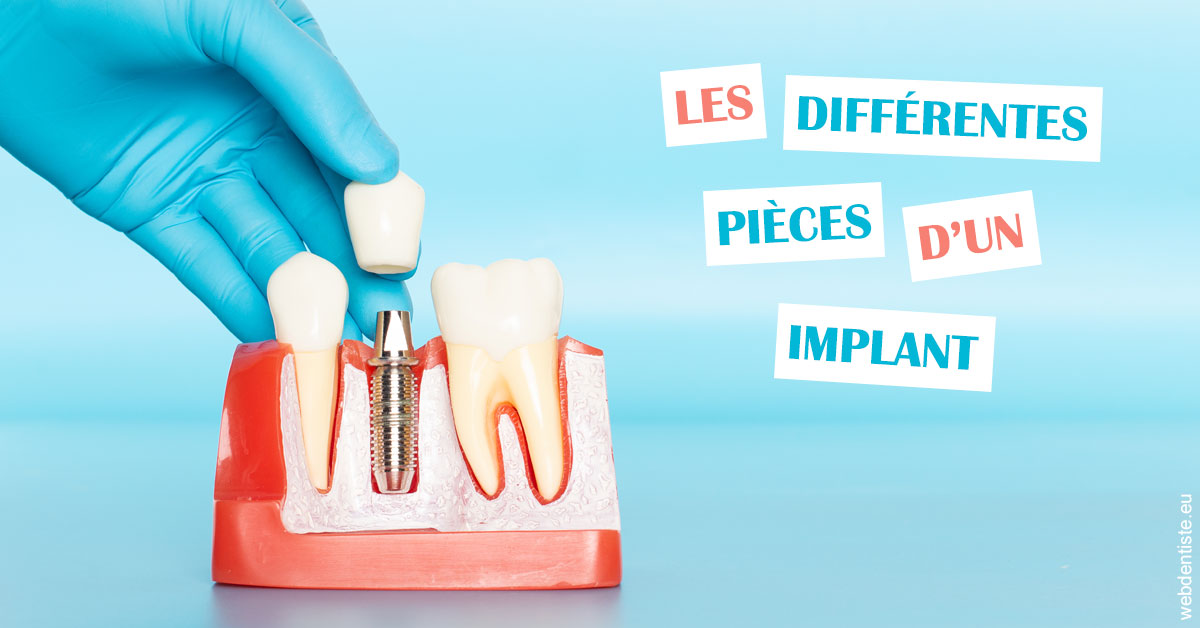 https://dr-nathalie-lambert.chirurgiens-dentistes.fr/Les différentes pièces d’un implant 2