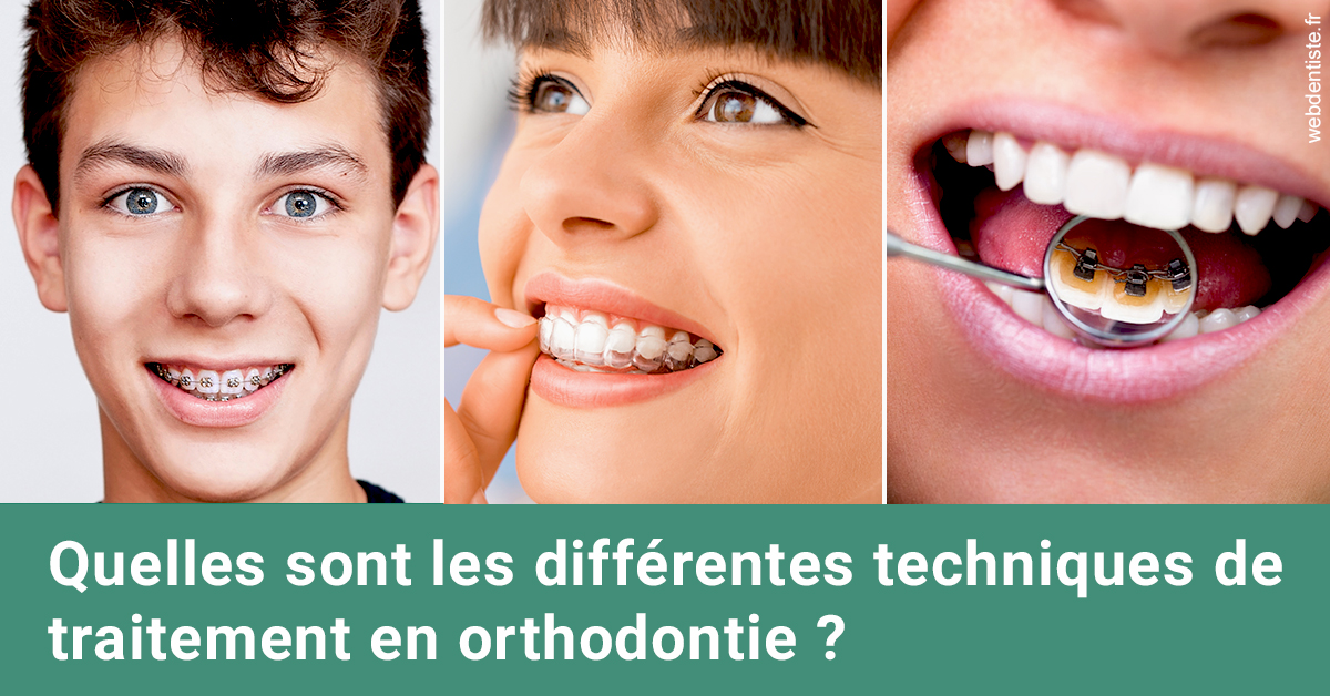 https://dr-nathalie-lambert.chirurgiens-dentistes.fr/Les différentes techniques de traitement 2