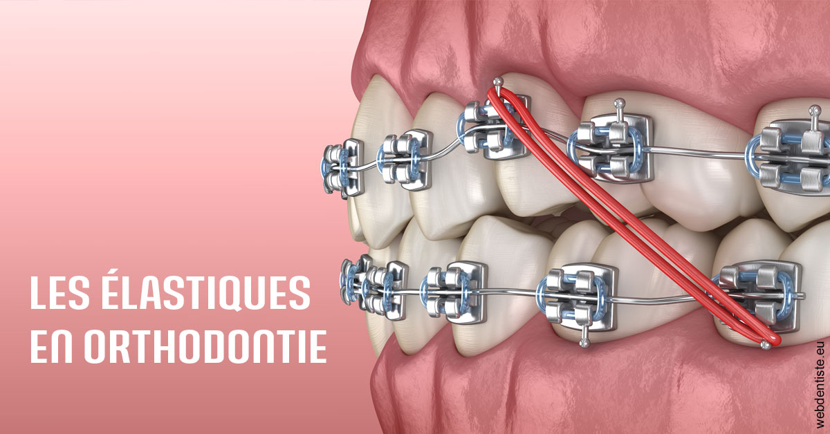 https://dr-nathalie-lambert.chirurgiens-dentistes.fr/Elastiques orthodontie 2