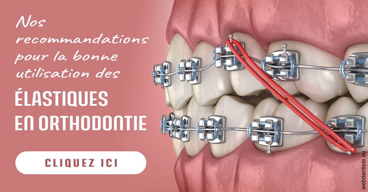 https://dr-nathalie-lambert.chirurgiens-dentistes.fr/Elastiques orthodontie 2